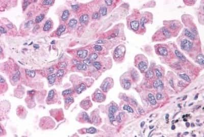 Immunohistochemistry: NEK6 Antibody [NBP3-14415]